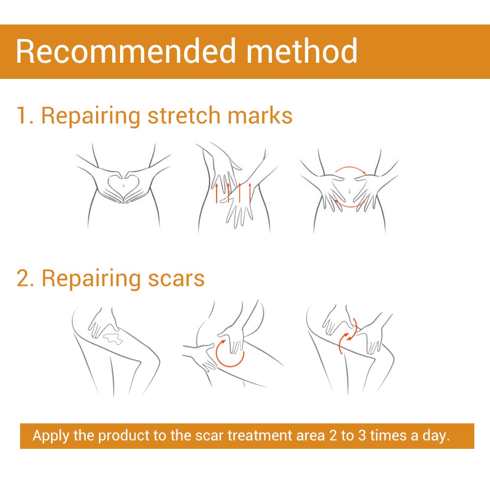 Stretch Mark Remover & Skin Care Scar Cream