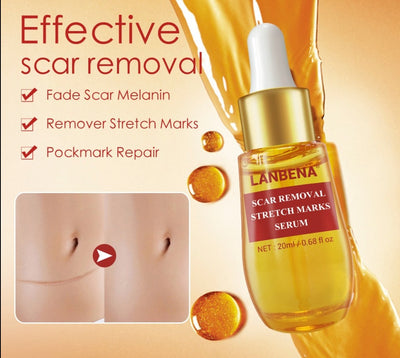 Stretch Mark Remover & Skin Care Scar Cream