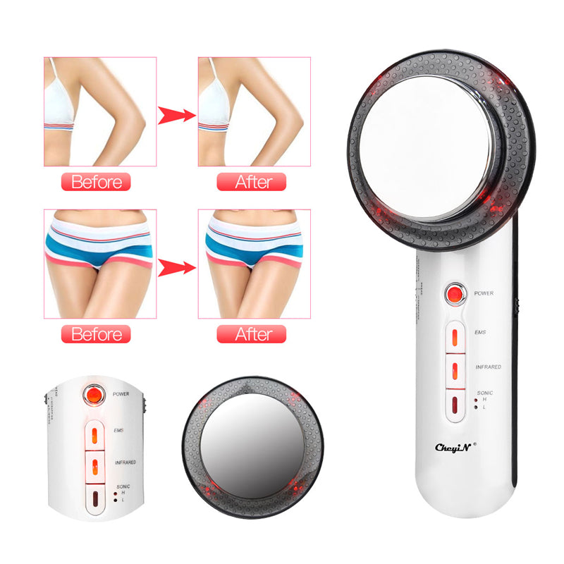 EMS Mesotherapy RF Radio Frequency Facial Beauty Device