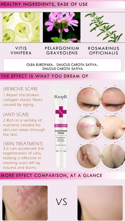 Acne Scar Removal Cream