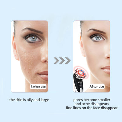 Positive & Negative Ion Facial Massager - GiGezz