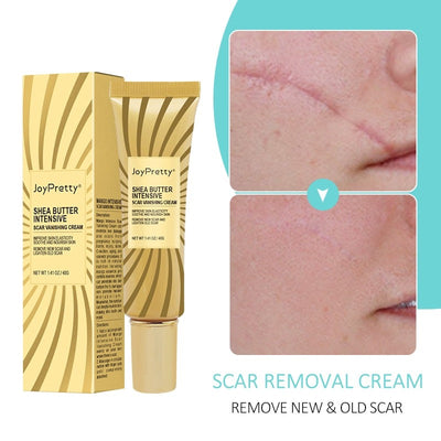 Acne Scar Removal Cream