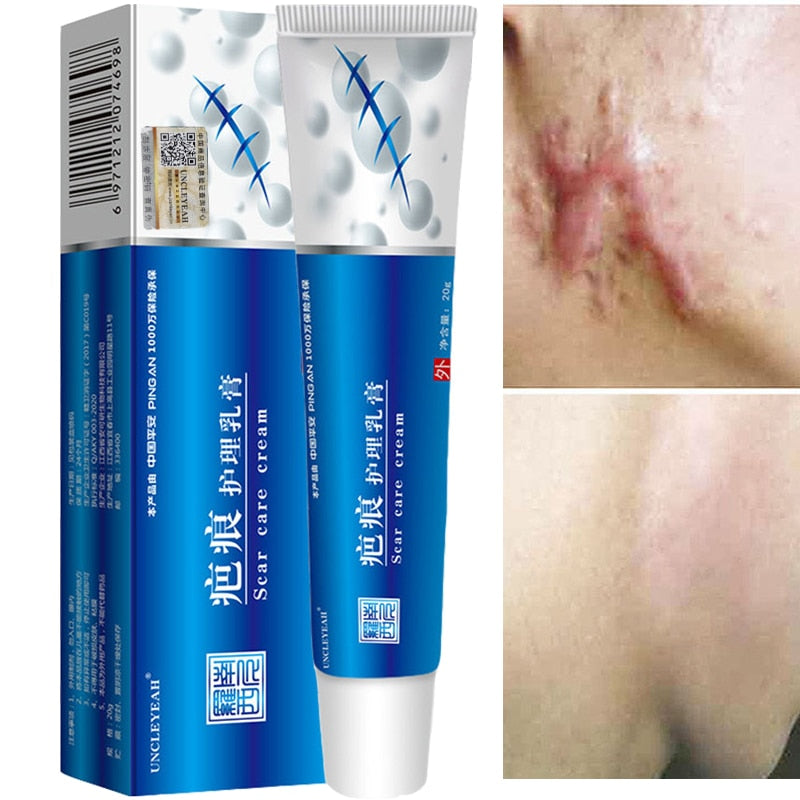 Acne Scar Removal Cream