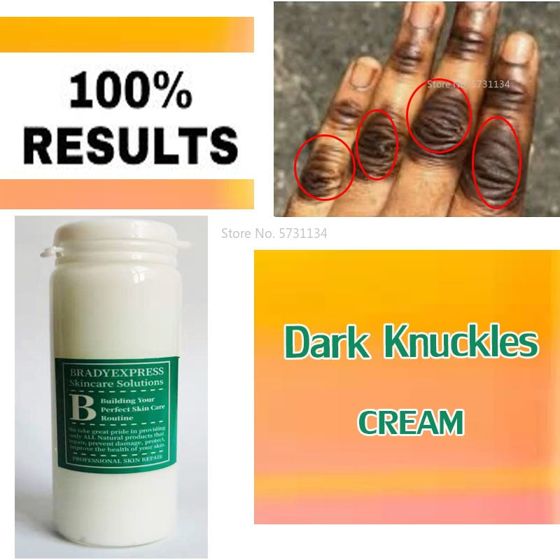 Dark Knuckles Spot Removal Cream